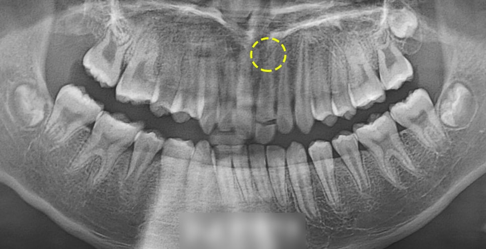 Treatment case image 2