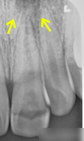 Treatment case image 3
