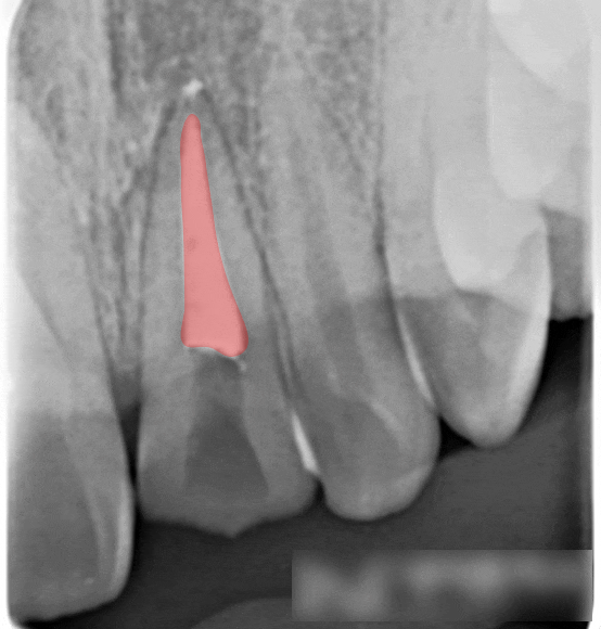 Treatment case image 7