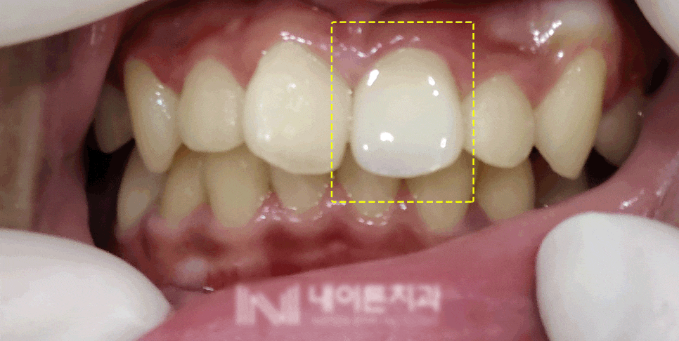 Treatment case image 8
