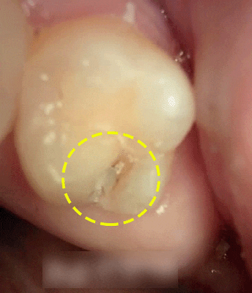 Treatment case image 1