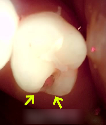 Treatment case image 2