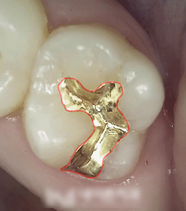 Treatment case image 5