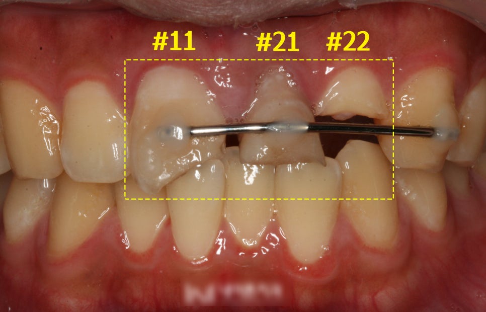 Treatment case image 1