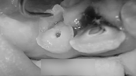 Treatment case image 3