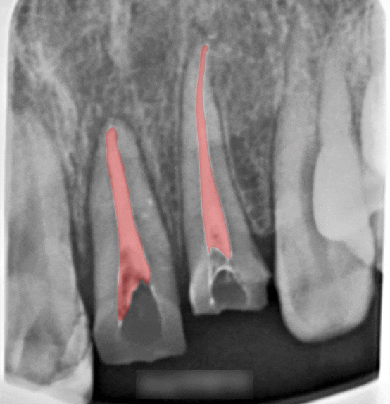 Treatment case image 4