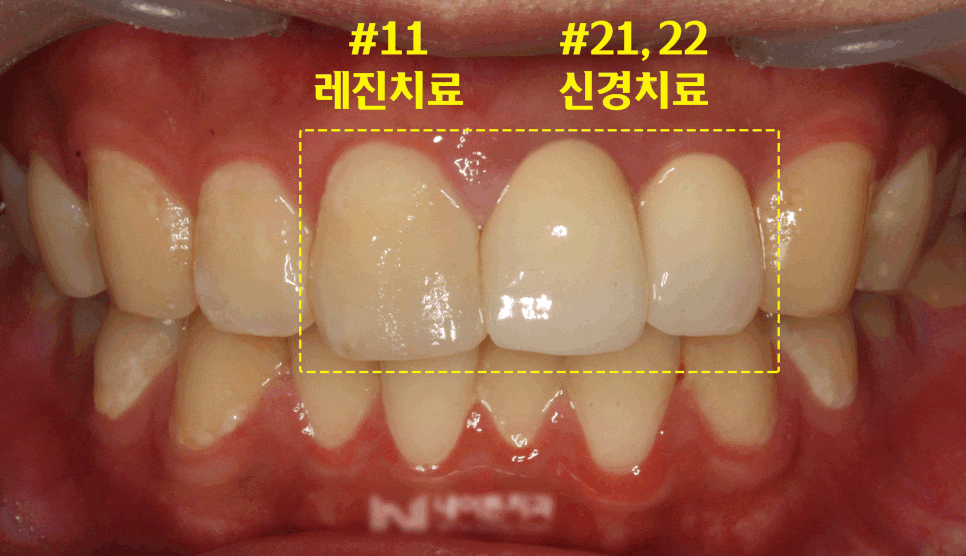 Treatment case image 5