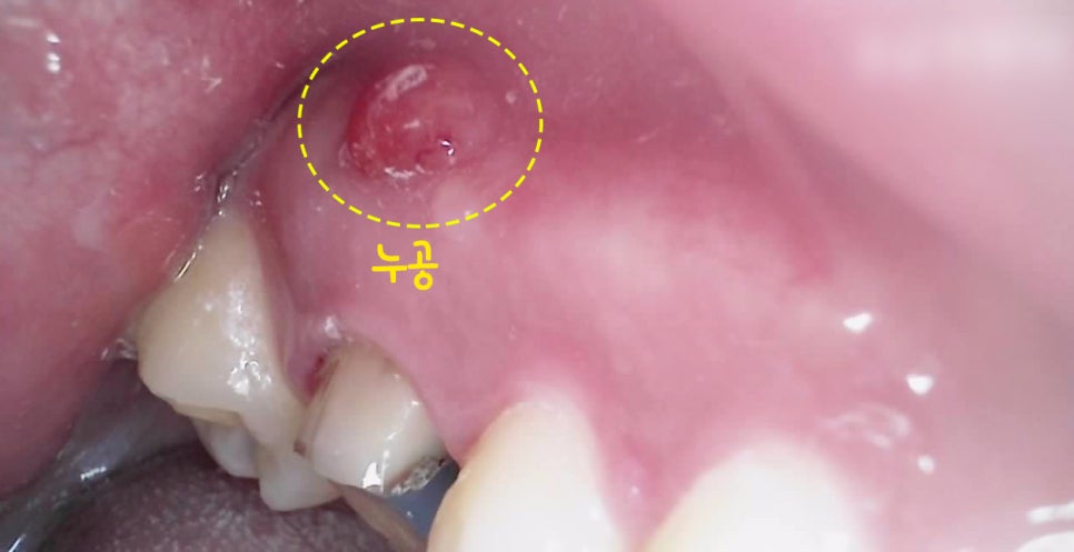 Treatment case image 1