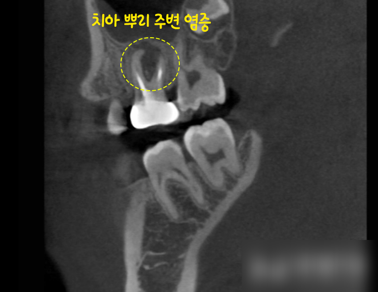 Treatment case image 2