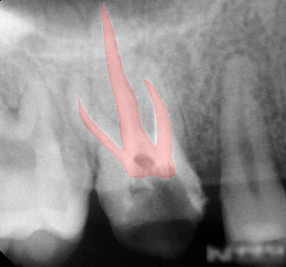 Treatment case image 5