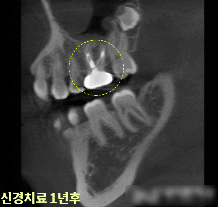 Treatment case image 7