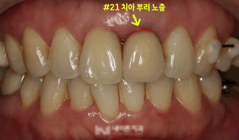 Treatment case image 1