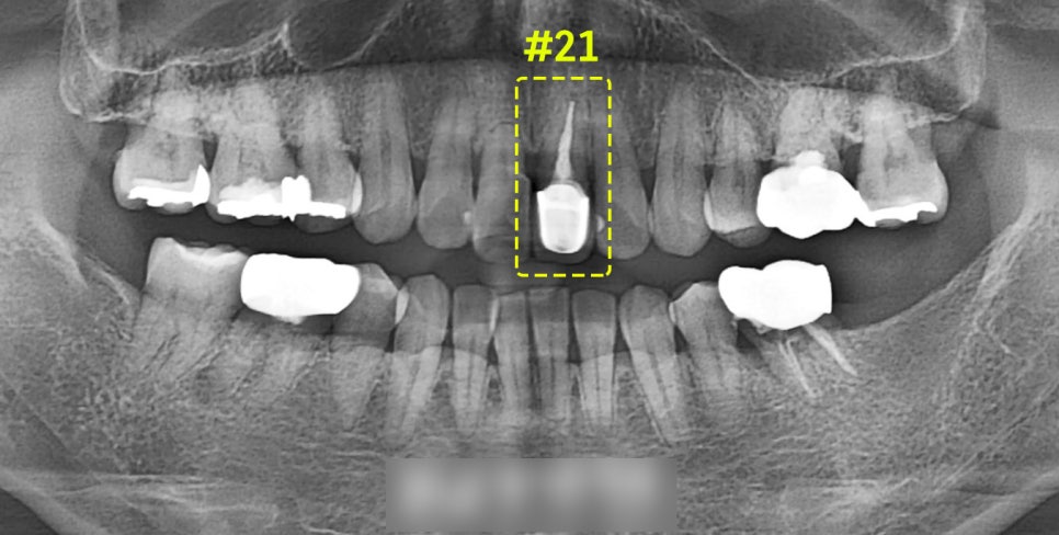 Treatment case image 2