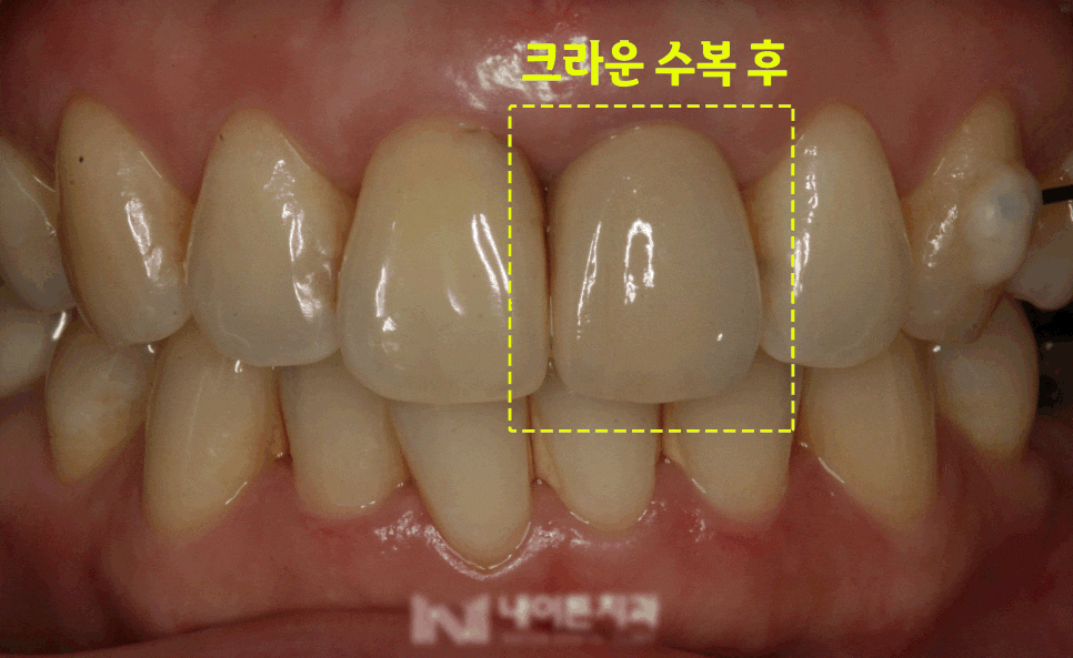 Treatment case image 3