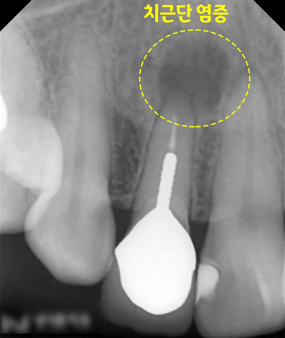 Treatment case image 1