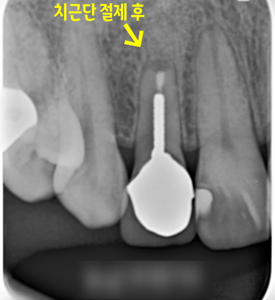 Treatment case image 2