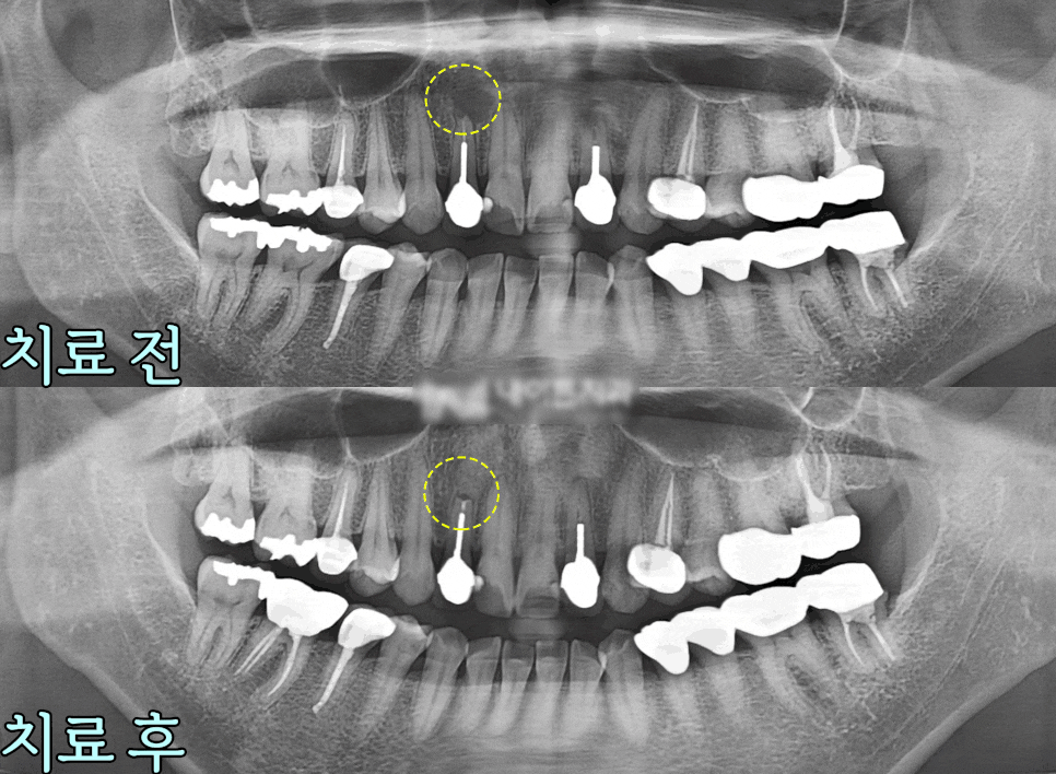 Treatment case image 4