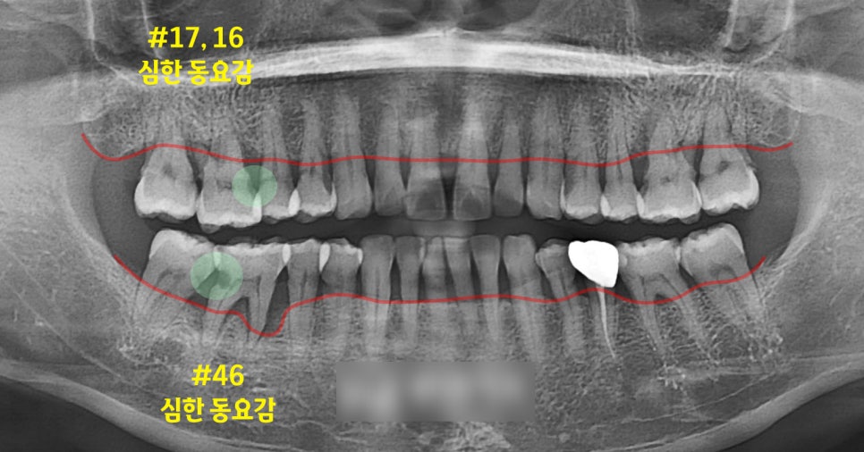 Treatment case image 1