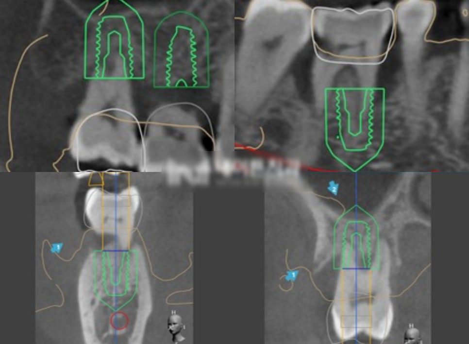 Treatment case image 3