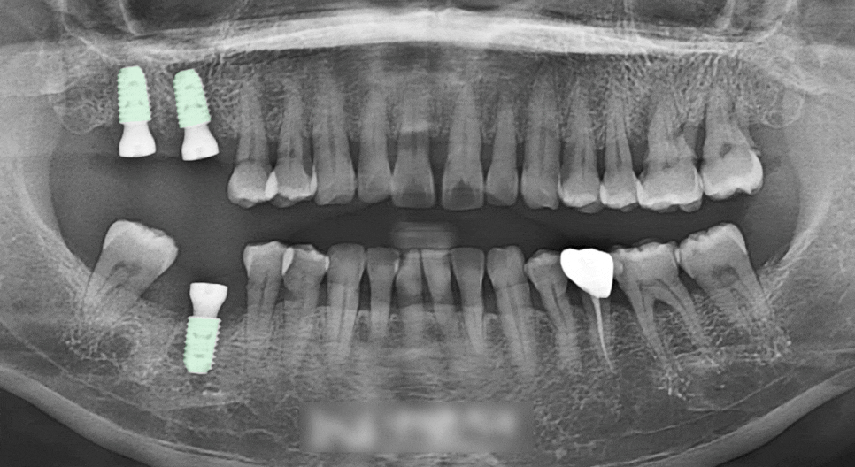 Treatment case image 4