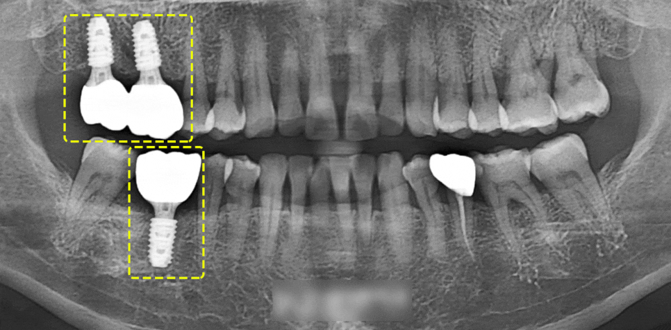 Treatment case image 5