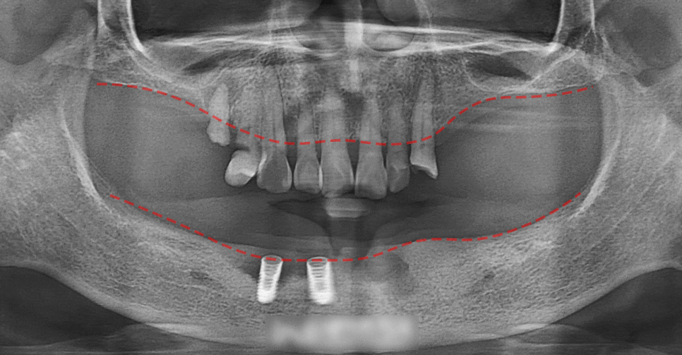 Treatment case image 1