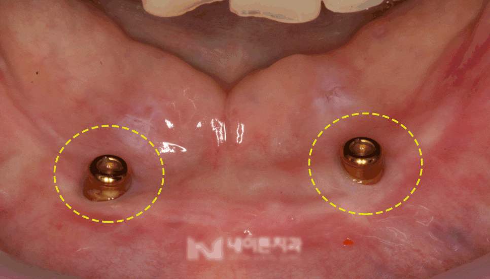 Treatment case image 3
