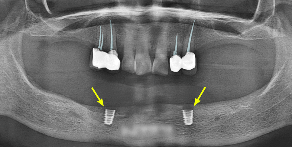 Treatment case image 4