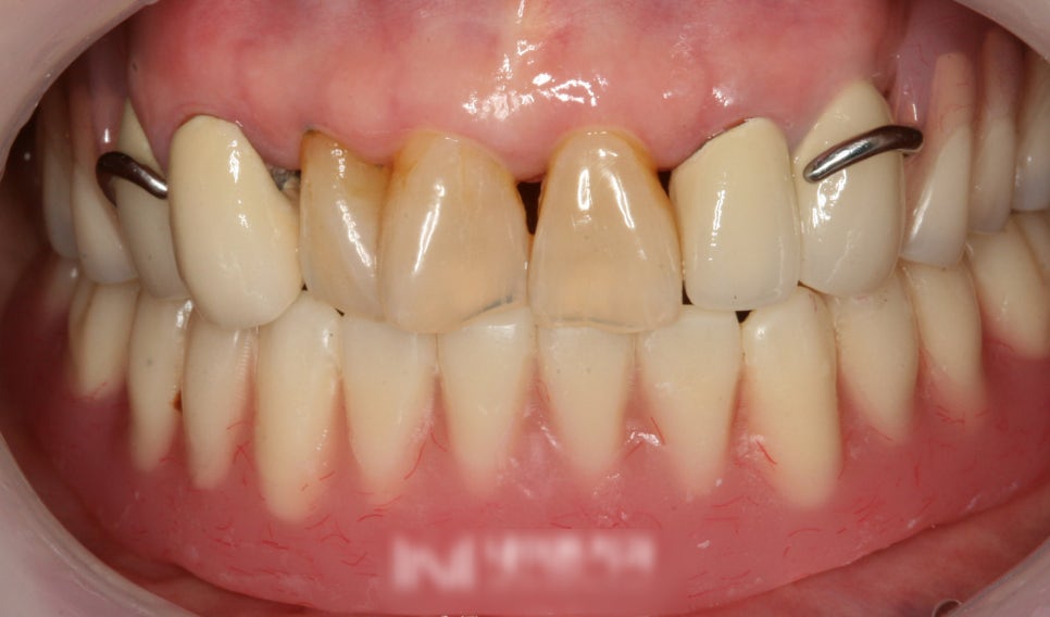 Treatment case image 5