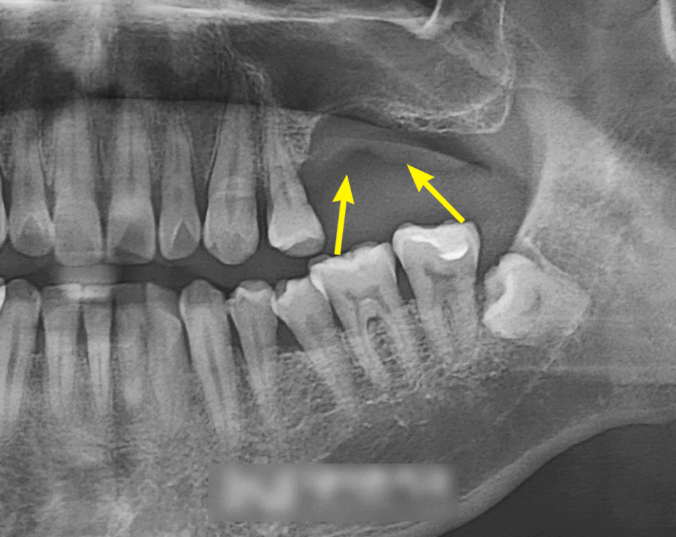 Treatment case image 1