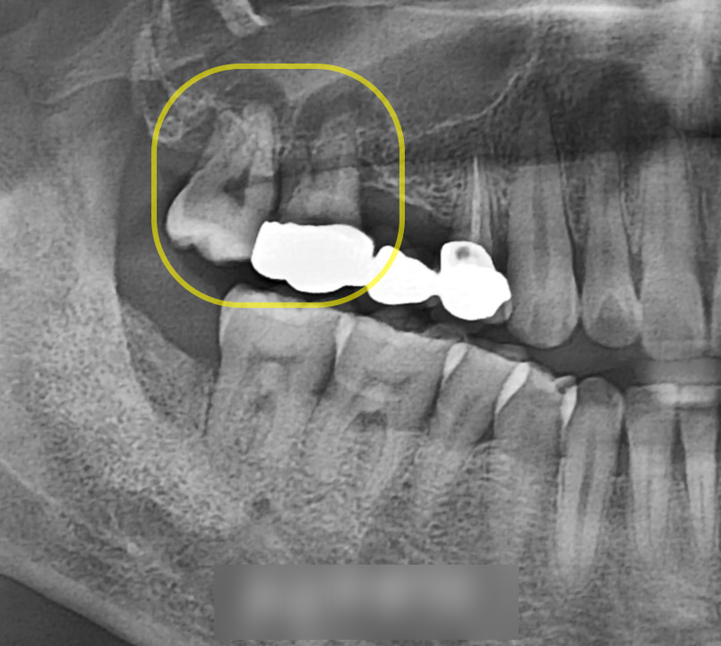 Treatment case image 2