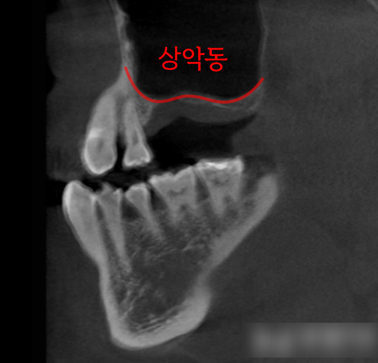 Treatment case image 3
