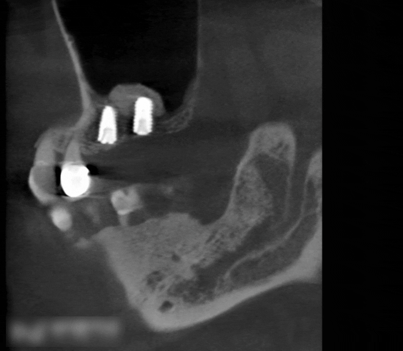 Treatment case image 5
