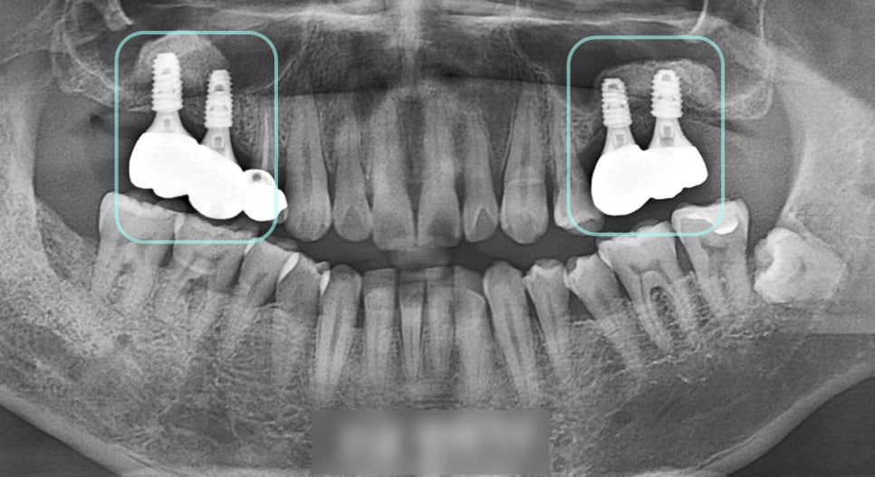 Treatment case image 7