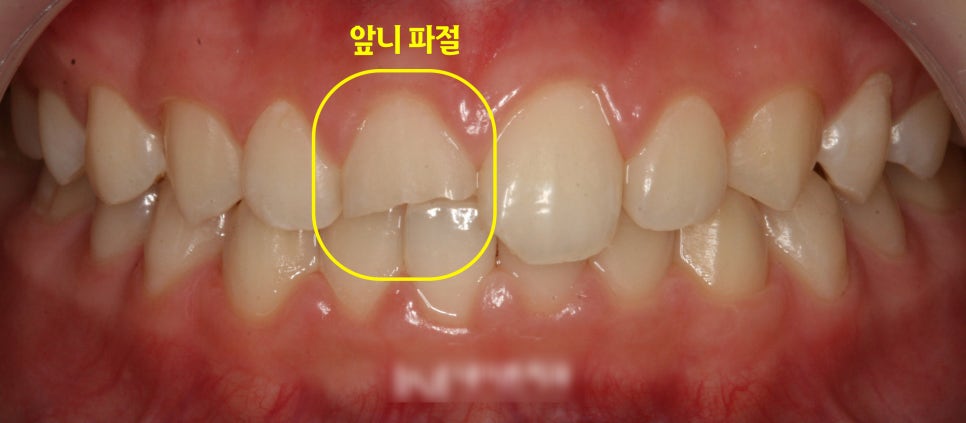 Treatment case image 1