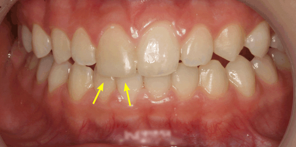 Treatment case image 3