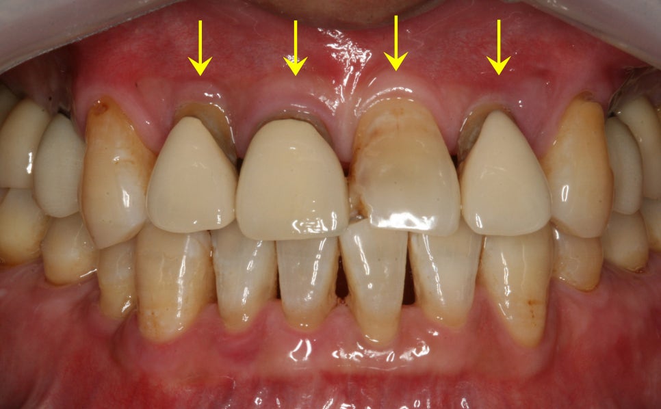 Treatment case image 1