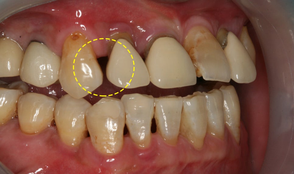 Treatment case image 3
