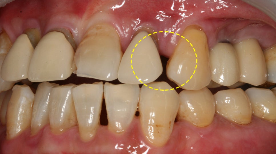 Treatment case image 4