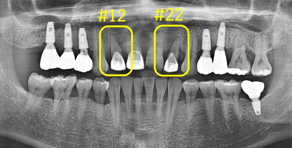 Treatment case image 5