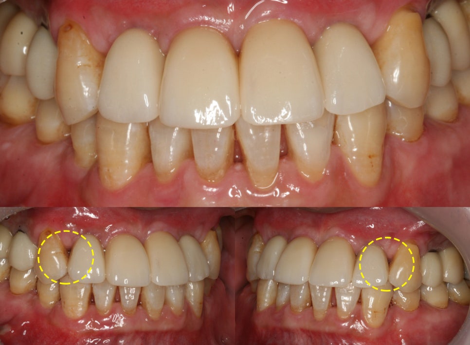 Treatment case image 6