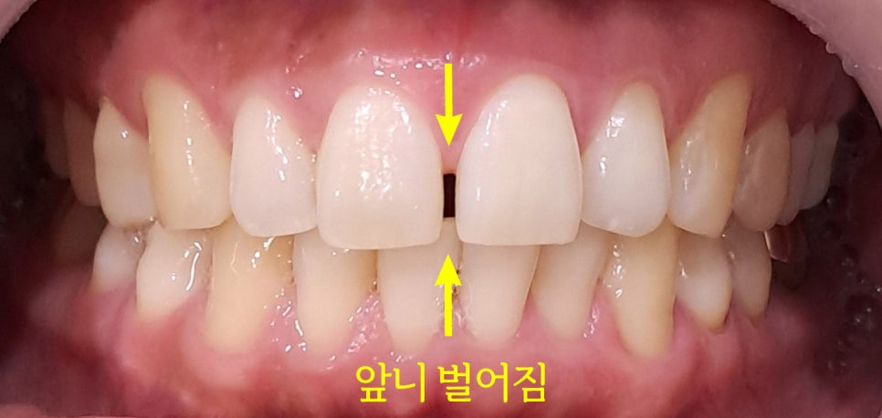 Treatment case image 1