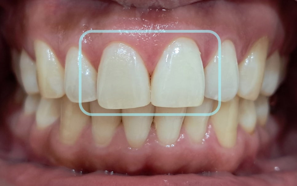 Treatment case image 3