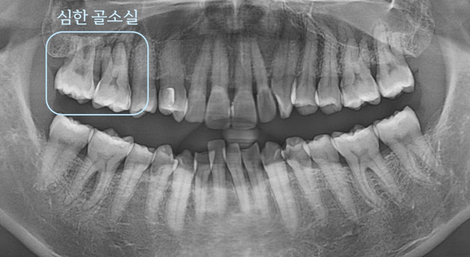 Treatment case image 1
