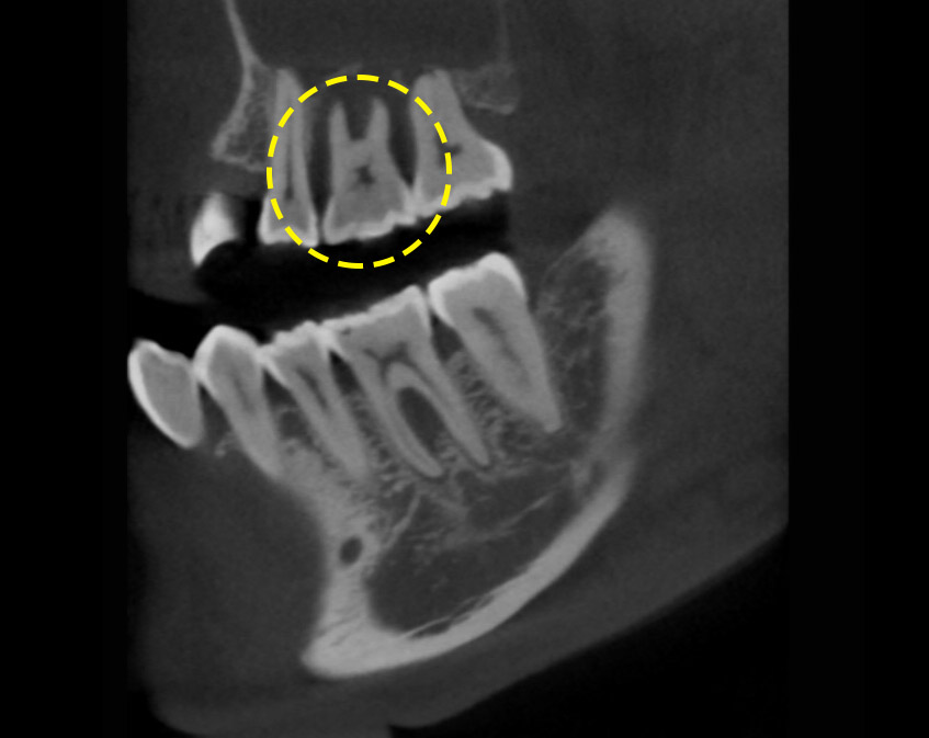 Treatment case image 2