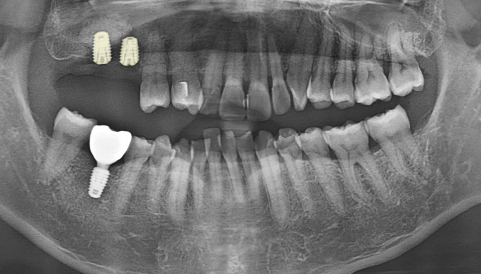 Treatment case image 3