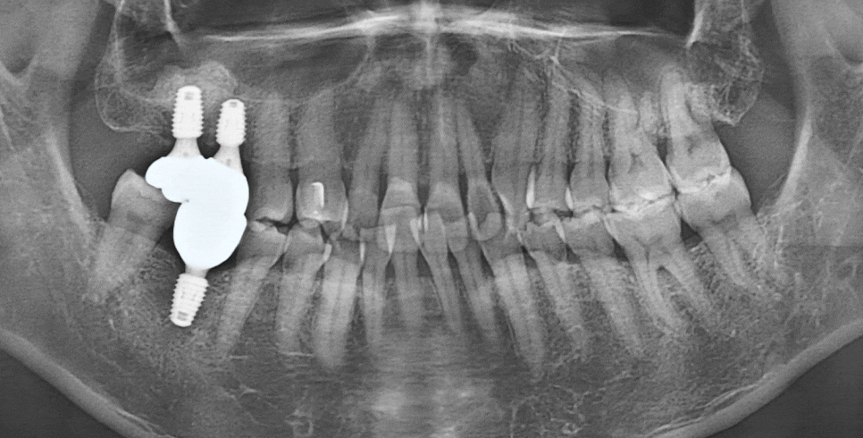 Treatment case image 4