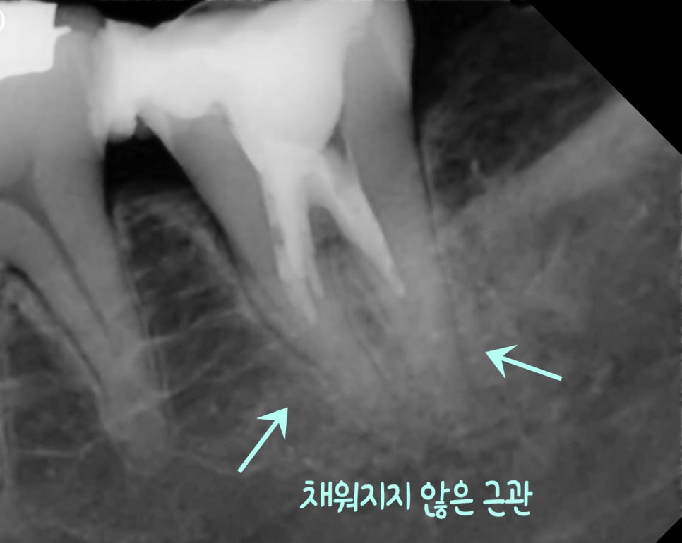 Treatment case image 1