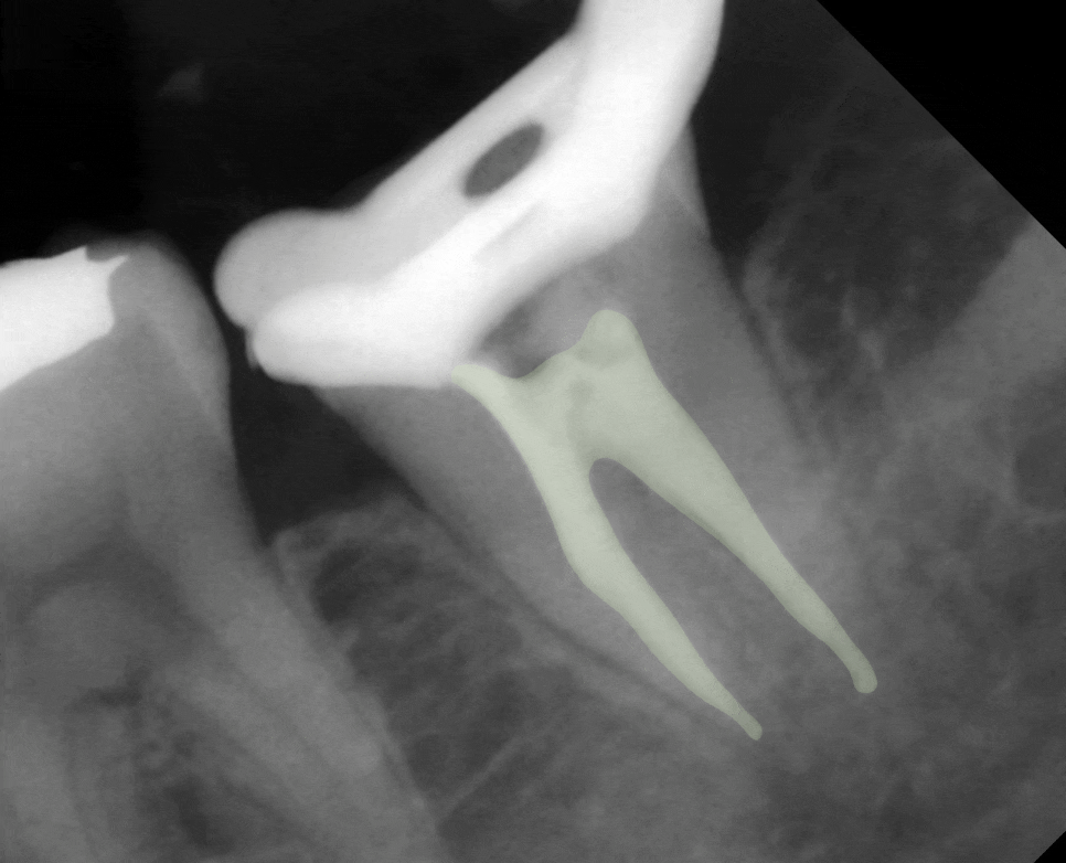 Treatment case image 4