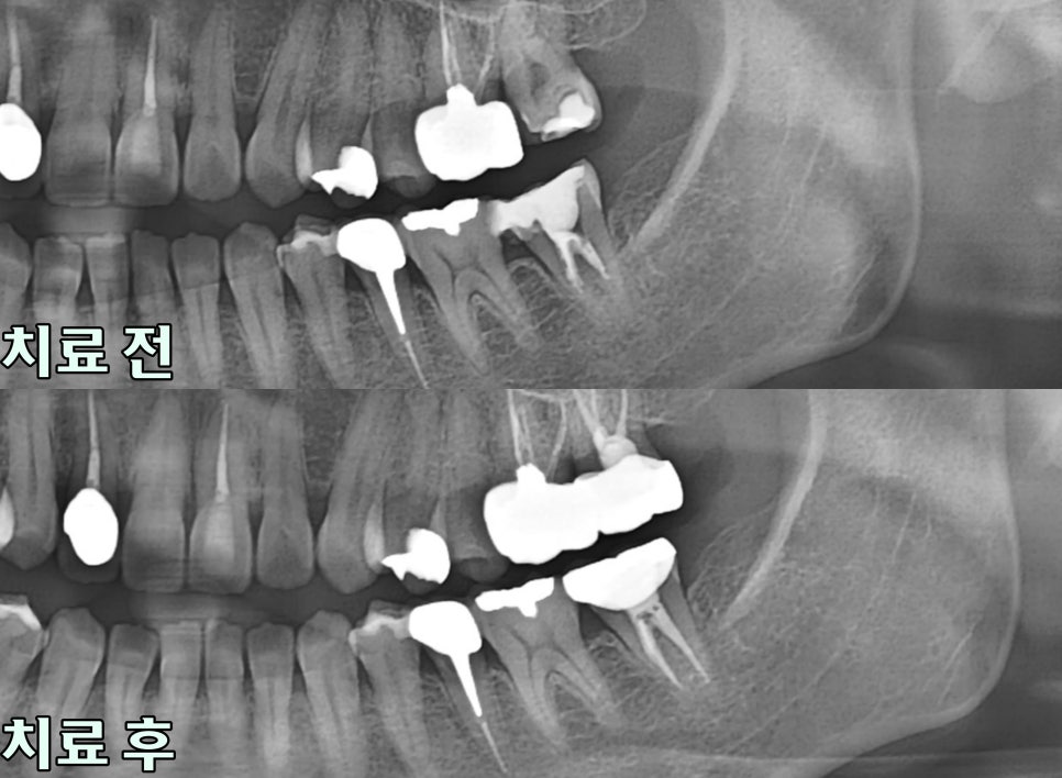 Treatment case image 5